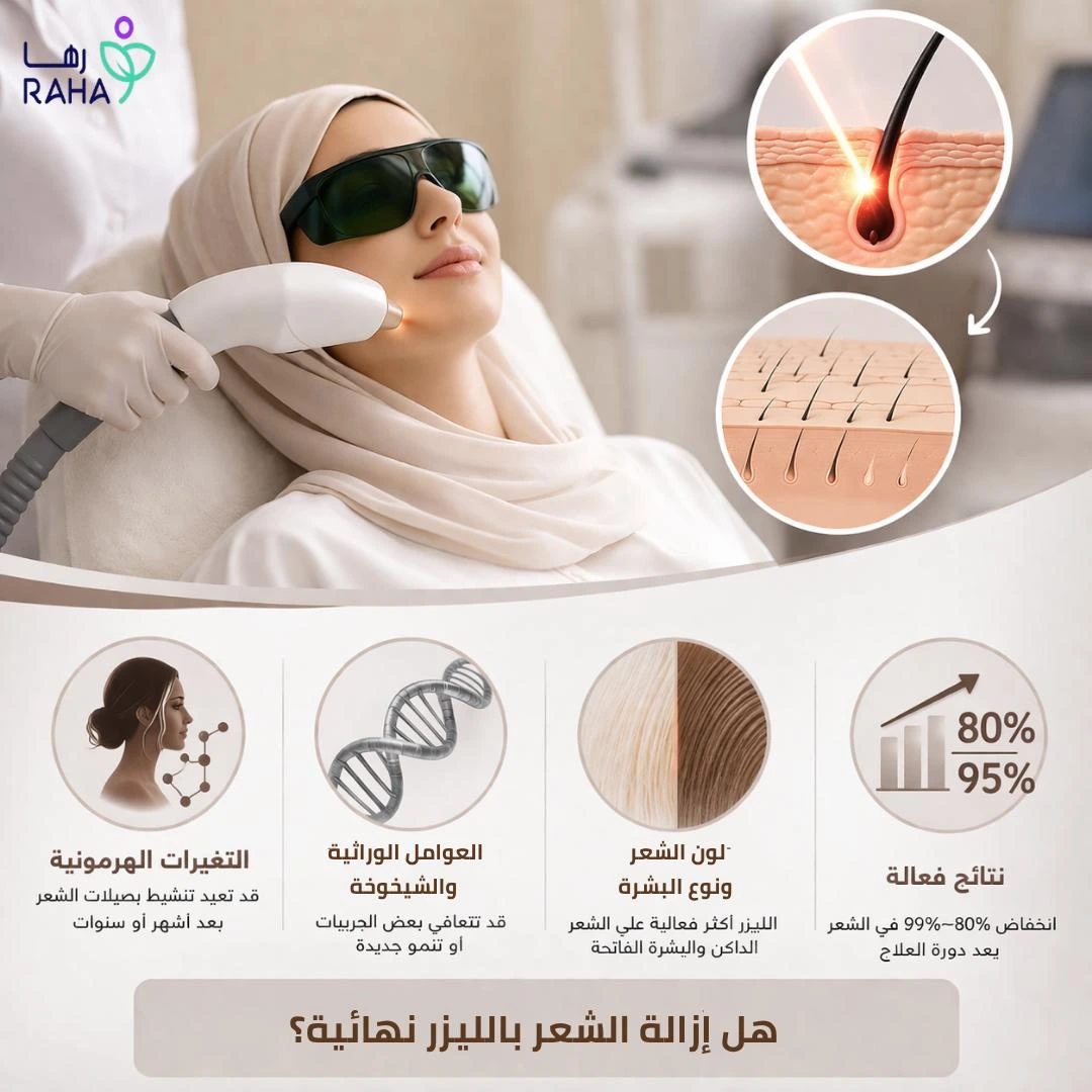 هل إزالة الشعر بالليزر نهائية؟ الحقيقة الكاملة